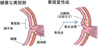 目の構造図